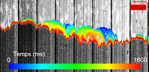 The jerky motion of a contact-line